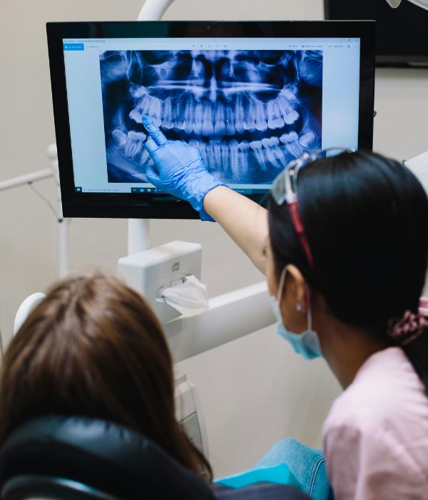 Digital dental X-ray